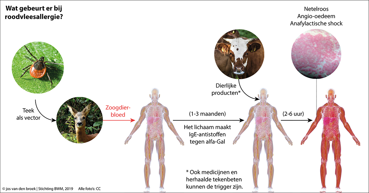 Allergisch voor steak na een teek? - Biowetenschappen & Maatschappij