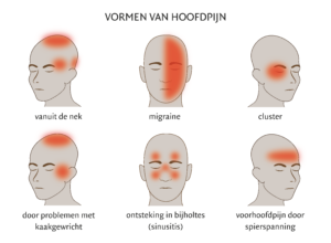Vormen van hoofdpijn
