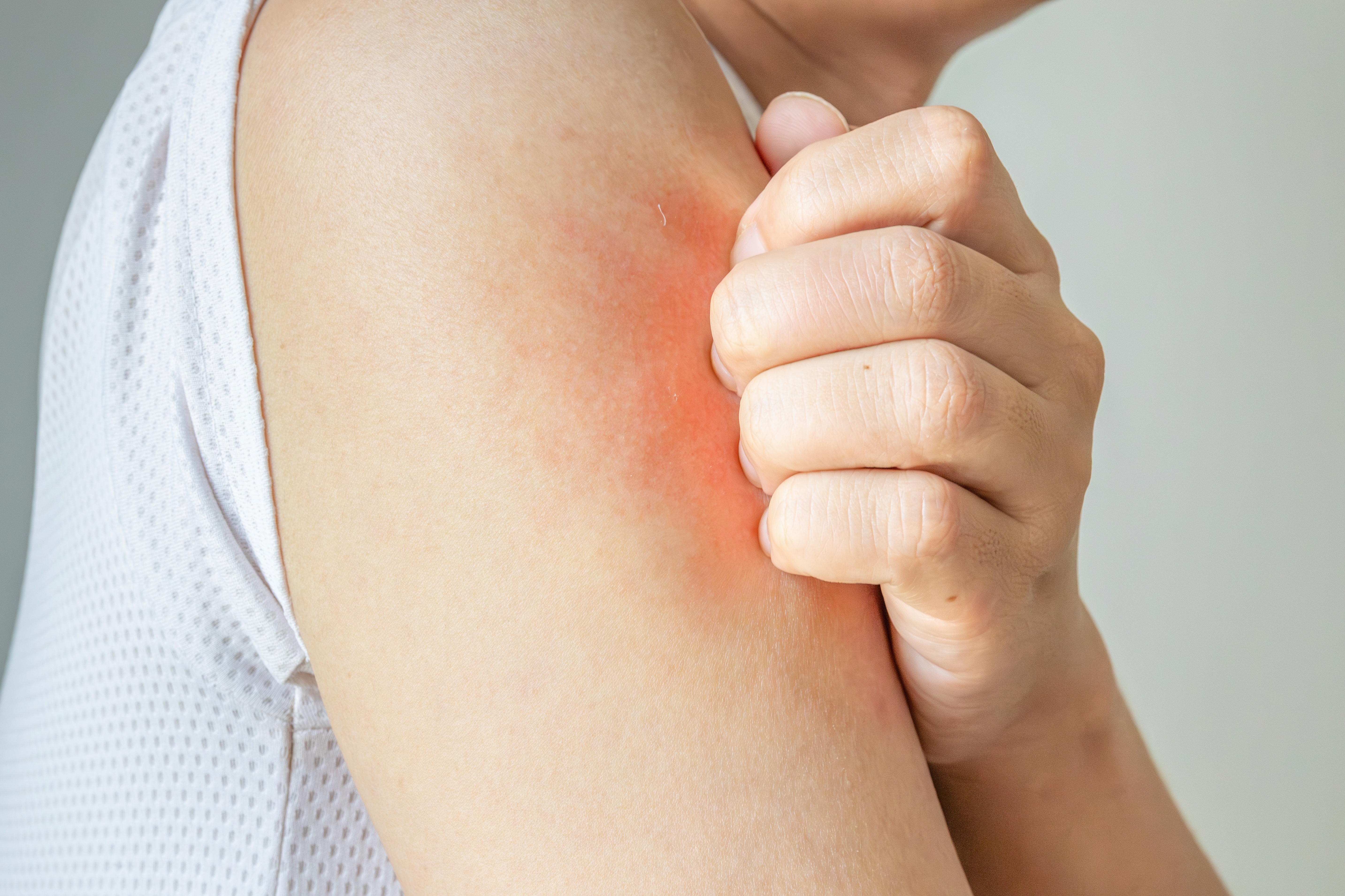 Is jeuk erger dan pijn?